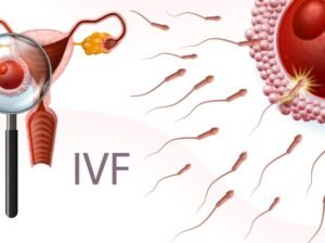 IVF-treatments